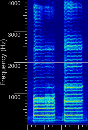 Spectrogram